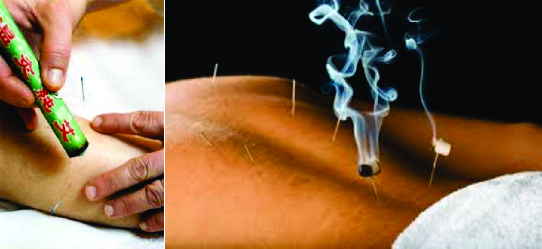 Tradicionalna kineska medicina